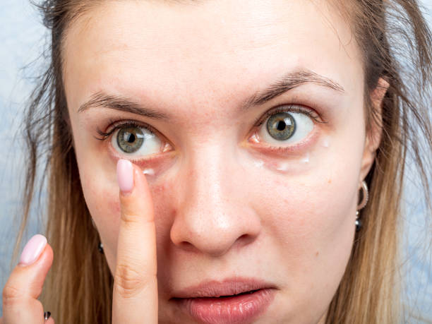 istock Young attractive woman does morning makeup applying cream around eyes 1209910206