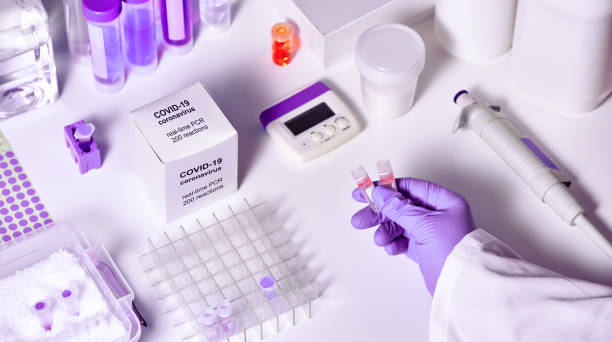 nuovo kit di diagnostica coronavirus 2019 ncov rt-pcr. contiene reagenti, primer e campioni di controllo per rilevare la presenza del virus 2019-ncov o covid19. diagnostica in vitro mediante analisi pcr in tempo reale. - dna kit foto e immagini stock