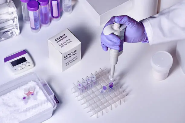 Photo of Novel coronavirus 2019 nCoV RT-PCR diagnostics kit. Reagents, primers and control samples to detect presence of 2019-nCoV or covid19 virus. In vitro diagnostic test based on real-time PCR method.