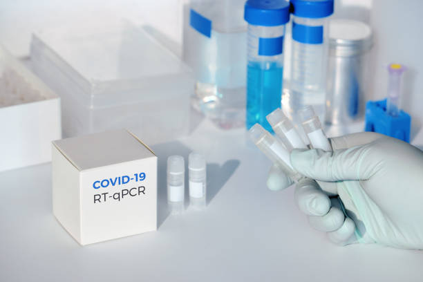 mano con provette per il nuovo coronavirus covid-19 in campioni medici. il kit rt-pcr viene utilizzato per rendere il frammento di dna complementare all'rna del gene virale a picco covid19. test per la presenza di 2019-ncov. - dna kit foto e immagini stock