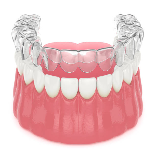 istock 3d render of invisalign removable retainer with lower jaw 1210031965