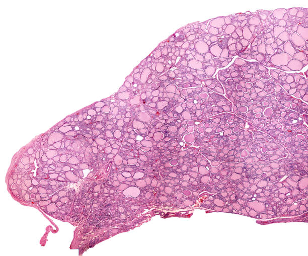 Human thyroid Low magnification micrograph showing a human thyroid. The thyroid parenchyma is composed by many follicle filled with colloid. Light microscope micrograph. Hematoxylin & eosin stain colloid stock pictures, royalty-free photos & images