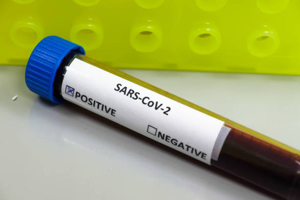 istock Blood test for COVID-19. 1210237918