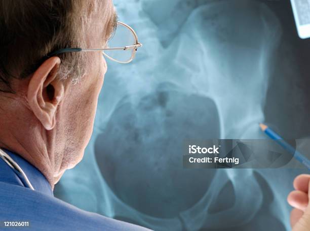 Foto de Osteoporose Doutor Examinando Um Raiox e mais fotos de stock de Osteoporose - Osteoporose, Bacia Artificial, Quadril