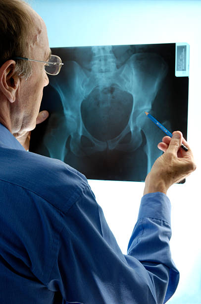 arzt untersuchen ein x-ray der boden region - hip replacement stock-fotos und bilder