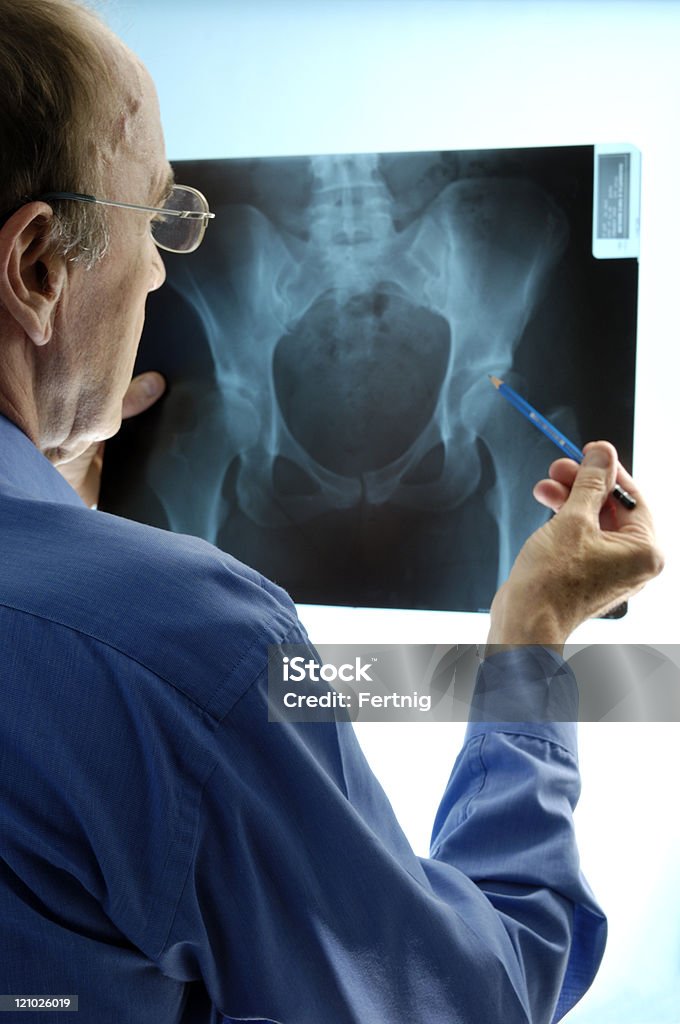 Doctor examining an x-ray of pelvic region  Hip - Body Part Stock Photo