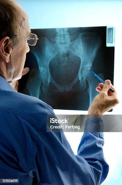 Doctor Examining An Xray Of Pelvic Region Stock Photo - Download Image Now - Hip - Body Part, Hip Replacement, X-ray Image