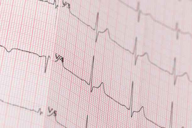 istock medical cardiogram on red paper 1210268548