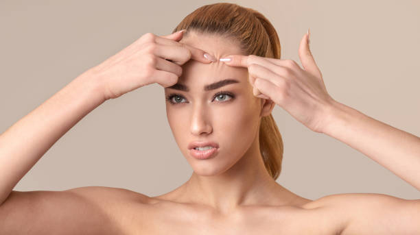 istock Girl Squeezing Pimple On Forehead Standing On Beige Background, Panorama 1210351547