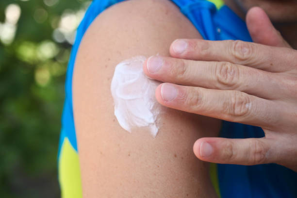 istock Mosquito repellent. Man using insect repellent cream outdoors. 1210380959