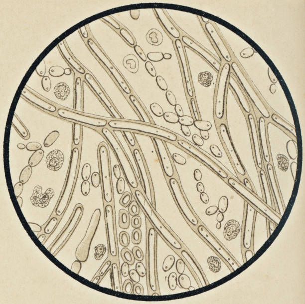 Microscopic View of Candida Albicans from a Patient with Mycosis - 19th Century Microscopic view of candida albican fungus bacteria (thrush) found in the oral tissue of a patient with mycosis. Vintage etching circa mid 19th century. vintage medical diagrams stock illustrations