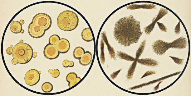 Microscopic View of Leucine and Tyrosine Crystals from Urinary Sediment - 19th Century Microscopic view of leucine crystals [left] and tyrosine crystals [right] in human urine. Vintage etching circa mid 19th century. tyrosine stock illustrations