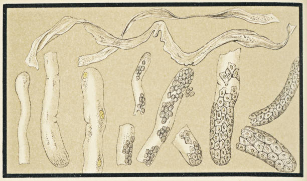istock Microscopic View of Human Urinary Casts from the Kidney - 19th Century 1210430861