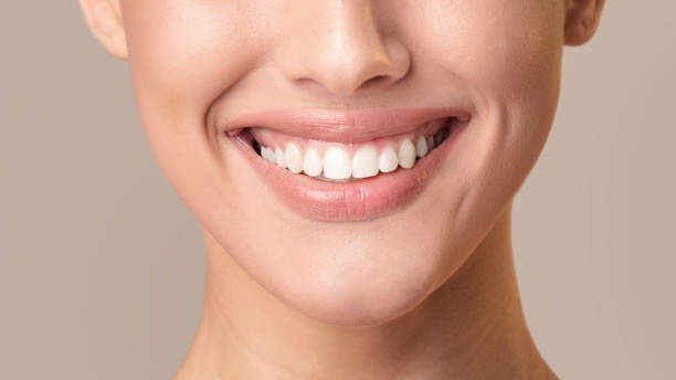 istock Unrecognizable Woman With White Teeth Smiling Posing On Beige Background 1210523912