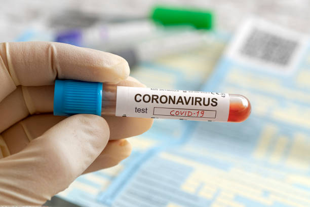 pielęgniarka posiadająca pozytywny wynik badania krwi dla nowego szybko rozprzestrzeniającego się coronavirus, pochodzący z chin. napis na etykiecie testu koronawirusa covid-19, - microbiology analyzing laboratory scrutiny zdjęcia i obrazy z banku zdjęć