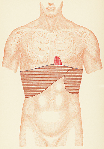 Medical illustration of human torso with the placement points for percussion exams for a patient with amyloidosis, front view. Vintage etching circa mid 19th century. Coloured zones indicate area for percussion exam.