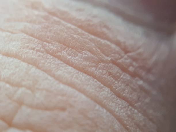 istock Human skin close up background 1210777122