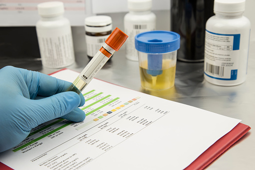 urine test in the laboratory