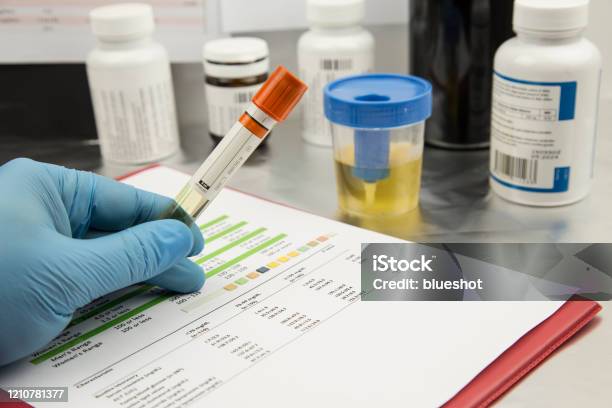 Urine Test Stock Photo - Download Image Now - Drug Test, Urine Sample, Laboratory