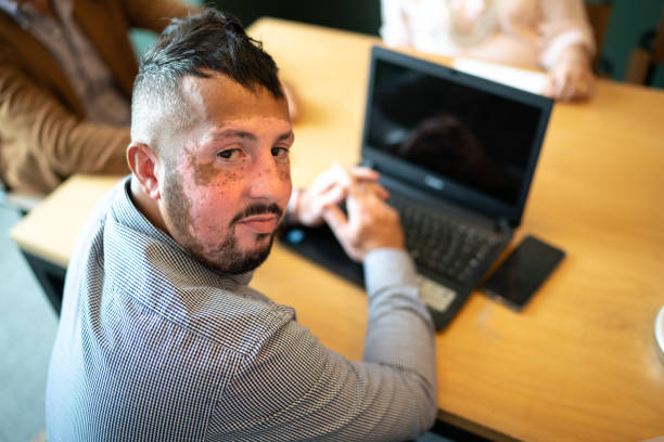 verticale de l’homme d’affaires avec le vitiligo à la salle de réunion - boardroom chairs photos et images de collection