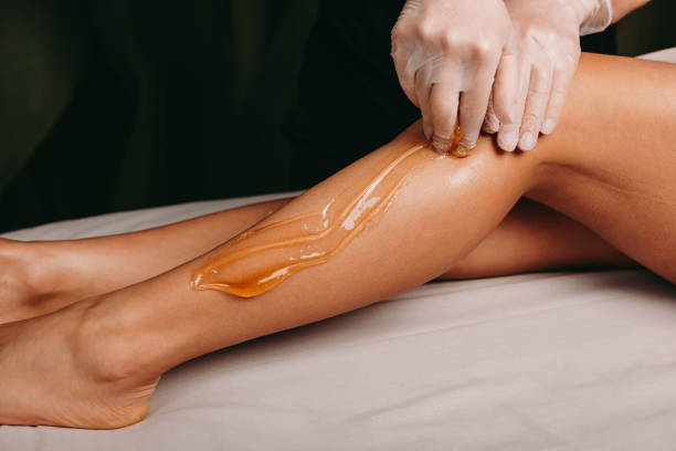 istock Sugaring epilation done in a spa salon by a young professional during a procedure 1211080501