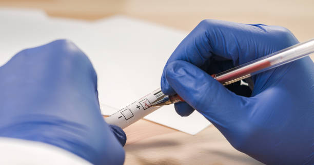 istock Marking Coronavirus infected blood sample tube 1211115352
