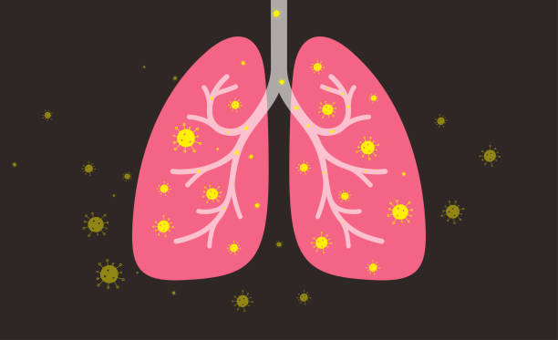 帶冠狀病毒的人類肺部 - 微生物學 插圖 幅插畫檔、美工圖案、卡通及圖標