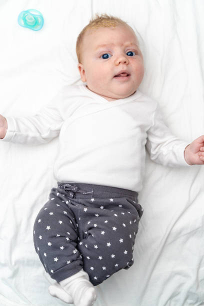 istock Cute baby with dermatologic problem Cradle Cap Seborrheic Dermatitis top view 1211165221