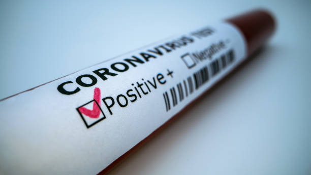 istock Positive COVID-19 test. Laboratory sample of blood testing for infection 1211314171