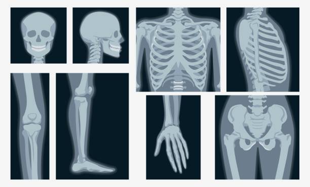 Different x-rays shot of human body part set vector flat illustration Different x-rays shot of human body part set vector flat illustration. Cartoon various x-ray pictures of head, hands, legs, torso of skeleton character isolated on white background knee to the head pose stock illustrations