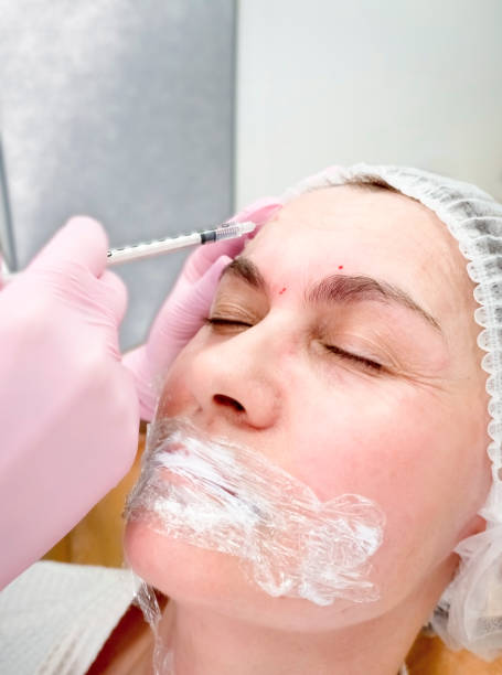 istock Woman getting botox injection in spa. contour plastic. A cosmetologist injects a botulinum toxin to tighten and smooth out wrinkles on the skin of a female face. Close-up. 1211401850