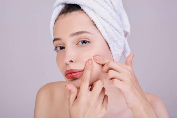 istock A woman with full lips crushes a pimple on her cheek. 1211508306