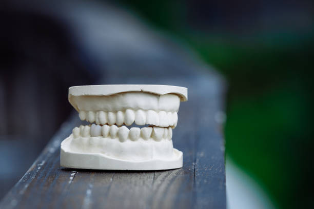 Animal Teeth Human Teeth Dentures White Stock Photos, Pictures & Royalty-Free Images - iStock Animal Teeth Human Teeth Dentures White Stock Photos, Pictures & Royalty-Free Images - iStock