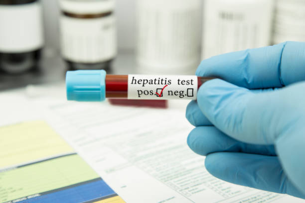 test d’hépatite - virus laboratory biotechnology cell photos et images de collection