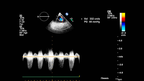 immagine del cuore durante gli ultrasuoni transesofagei. - human heart pulse trace heart valve cardiac conduction system foto e immagini stock