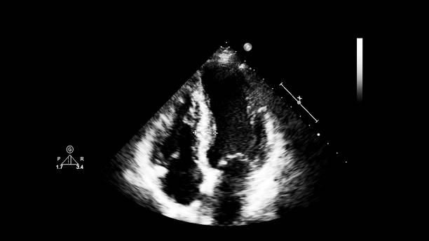 immagine del cuore durante gli ultrasuoni transesofagei. - human heart pulse trace heart valve cardiac conduction system foto e immagini stock