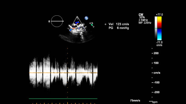 immagine del cuore durante gli ultrasuoni transesofagei. - human heart pulse trace heart valve cardiac conduction system foto e immagini stock