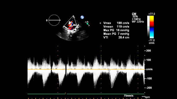 immagine del cuore durante gli ultrasuoni transesofagei. - human heart pulse trace heart valve cardiac conduction system foto e immagini stock