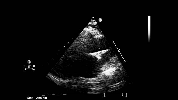 immagine del cuore durante gli ultrasuoni transesofagei. - human heart pulse trace heart valve cardiac conduction system foto e immagini stock