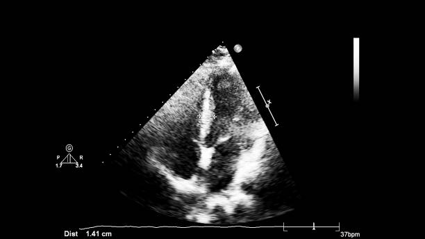 immagine del cuore durante gli ultrasuoni transesofagei. - human heart pulse trace heart valve cardiac conduction system foto e immagini stock