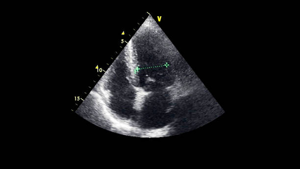 immagine del cuore durante gli ultrasuoni transesofagei. - human heart pulse trace heart valve cardiac conduction system foto e immagini stock