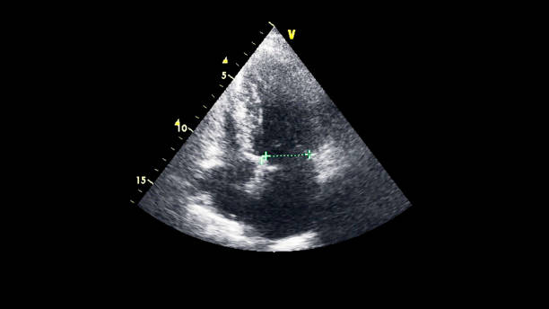 immagine del cuore durante gli ultrasuoni transesofagei. - human heart pulse trace heart valve cardiac conduction system foto e immagini stock