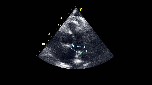 immagine del cuore durante gli ultrasuoni transesofagei. - human heart pulse trace heart valve cardiac conduction system foto e immagini stock