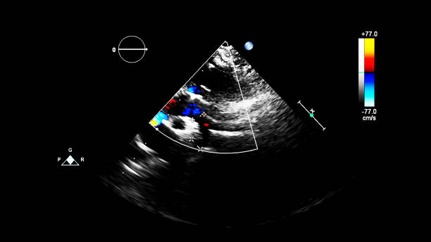 immagine del cuore durante gli ultrasuoni transesofagei. - human heart pulse trace heart valve cardiac conduction system foto e immagini stock
