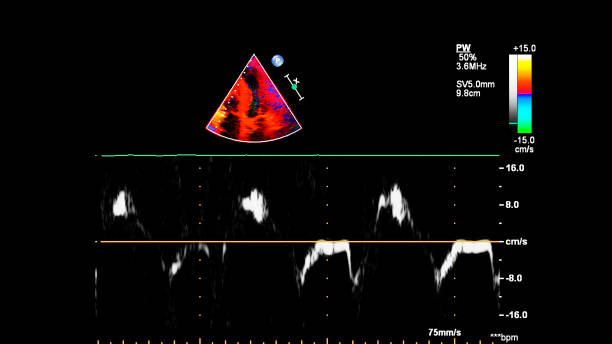 immagine del cuore durante gli ultrasuoni transesofagei. - human heart pulse trace heart valve cardiac conduction system foto e immagini stock