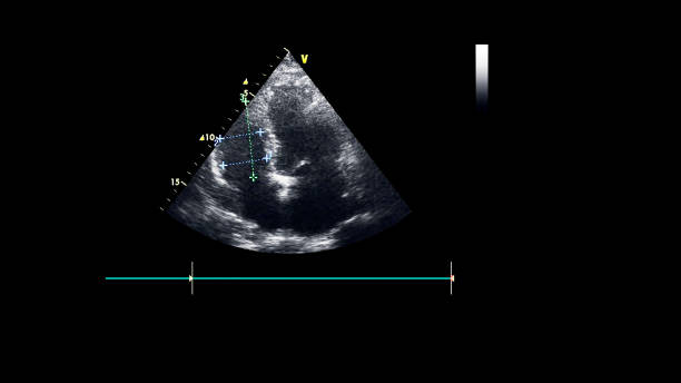 immagine del cuore durante gli ultrasuoni transesofagei. - human heart pulse trace heart valve cardiac conduction system foto e immagini stock