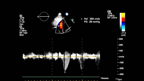 immagine del cuore durante gli ultrasuoni transesofagei. - human heart pulse trace heart valve cardiac conduction system foto e immagini stock