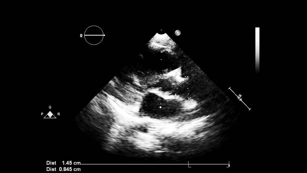 immagine del cuore durante gli ultrasuoni transesofagei. - human heart pulse trace heart valve cardiac conduction system foto e immagini stock