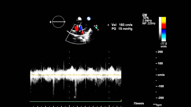 immagine del cuore durante gli ultrasuoni transesofagei. - human heart pulse trace heart valve cardiac conduction system foto e immagini stock