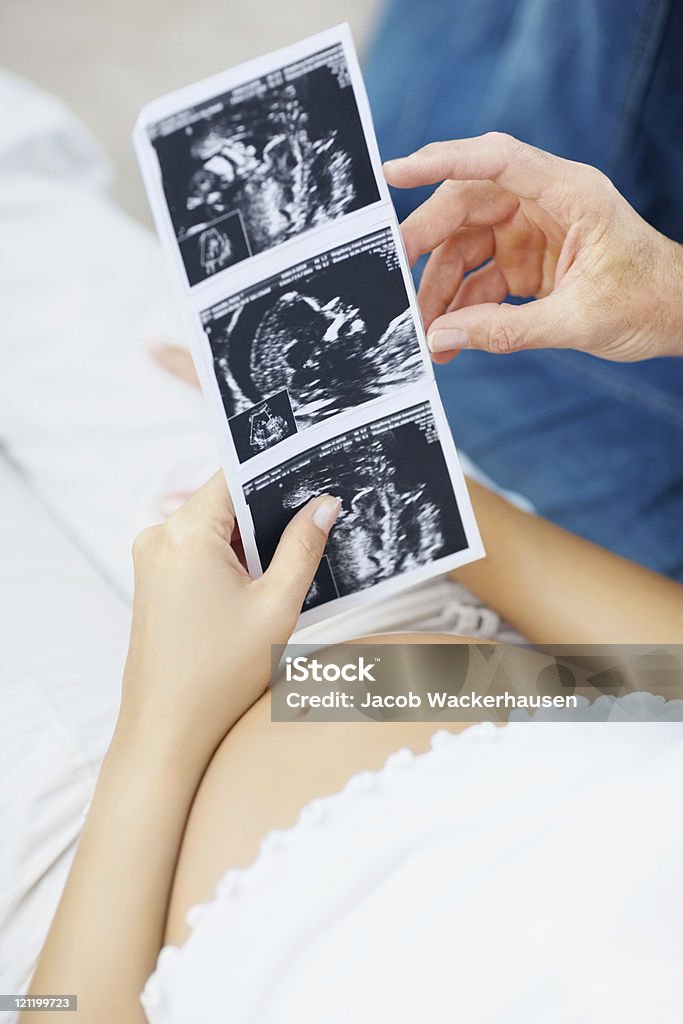 Detalhe de um casal com seus unborn sonogram criança - Foto de stock de Abdômen Humano royalty-free